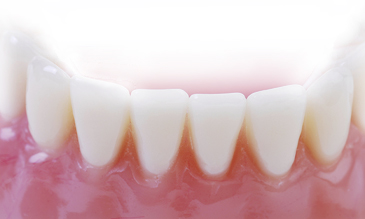 Periodontics will prevent gum disease